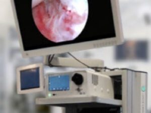 Endoscopy Accessories